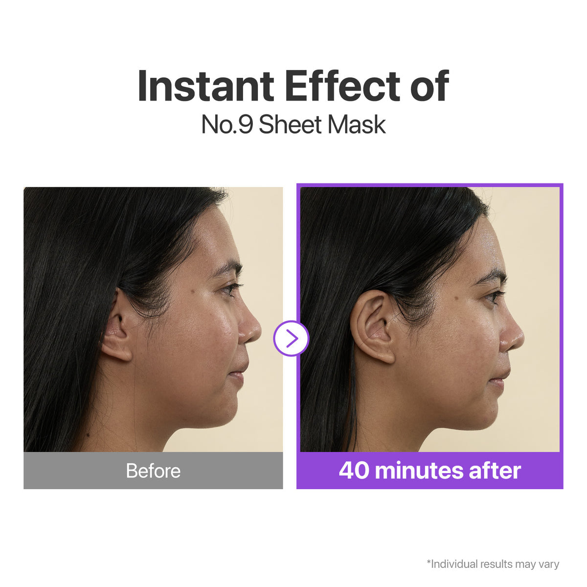 No.9 NAD+ BIO Lifting-sil Full Face Mask (4 Sheets + Lifting Band)