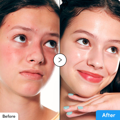 Eqqual Berry Hyaltoin Flooding Serum